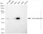KD-Validated Anti-Tumor Protein P53 Rabbit Polyclonal Antibody